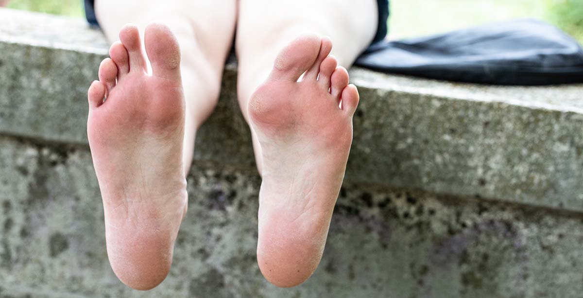 Bunion Correction & Relief